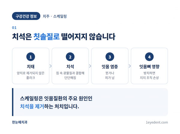 스케일링 건강보험 적용 기준과 진료 과정 (2)