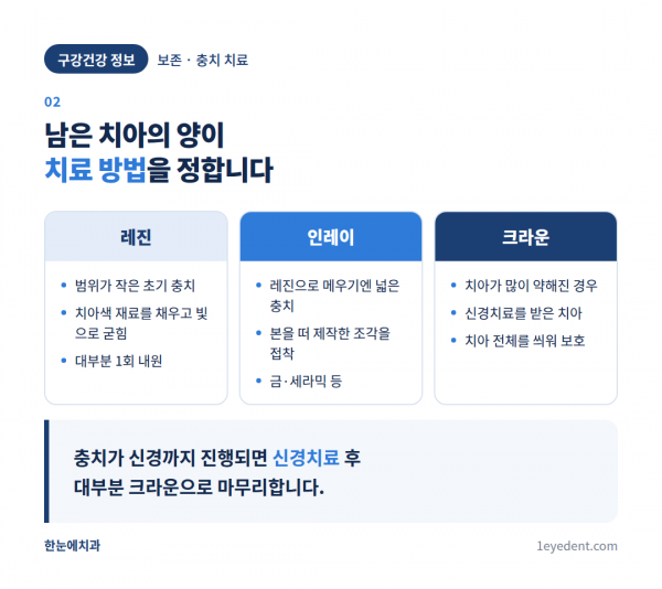 충치 진행 단계별 치료법: 레진·인레이·크라운 (3)