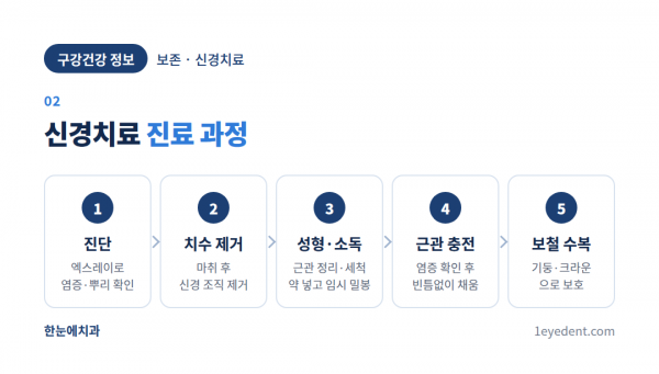 신경치료는 왜 여러 번 내원해야 하나 (3)
