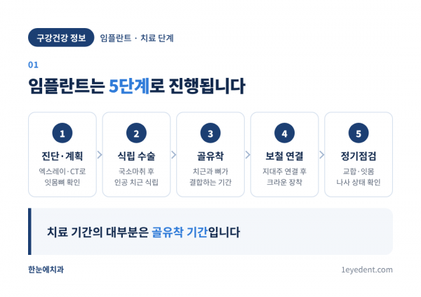 임플란트 치료 단계와 전체 기간 (2)